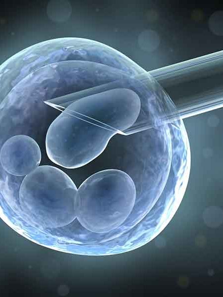 IVF and assisted reproduction