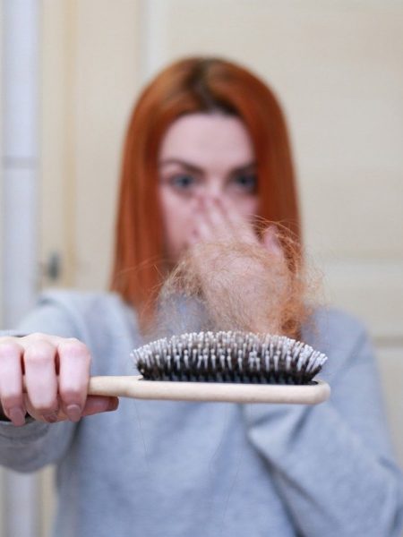 Essential Facts Related To Hair Loss Treatment For Women!